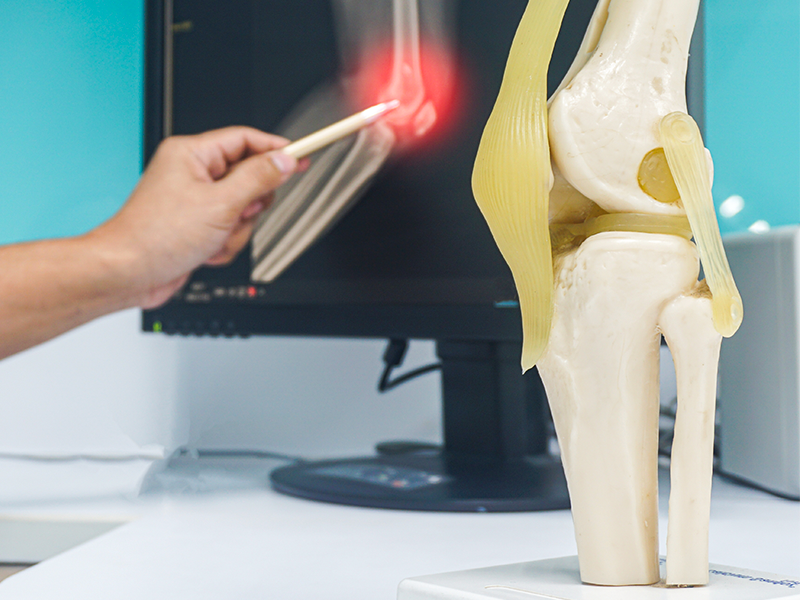What Is an Orthopedic Surgeon: What Do They Do?