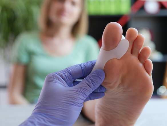 Types of bunion correction surgery