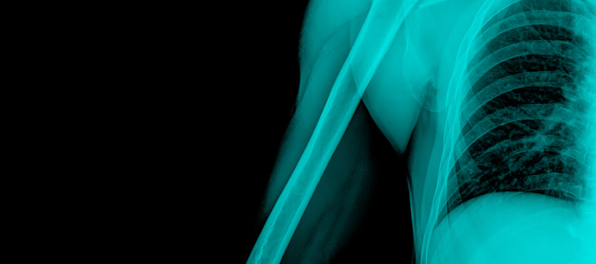 The Orthopedic Institute of New Jersey Launches Bone Health Center