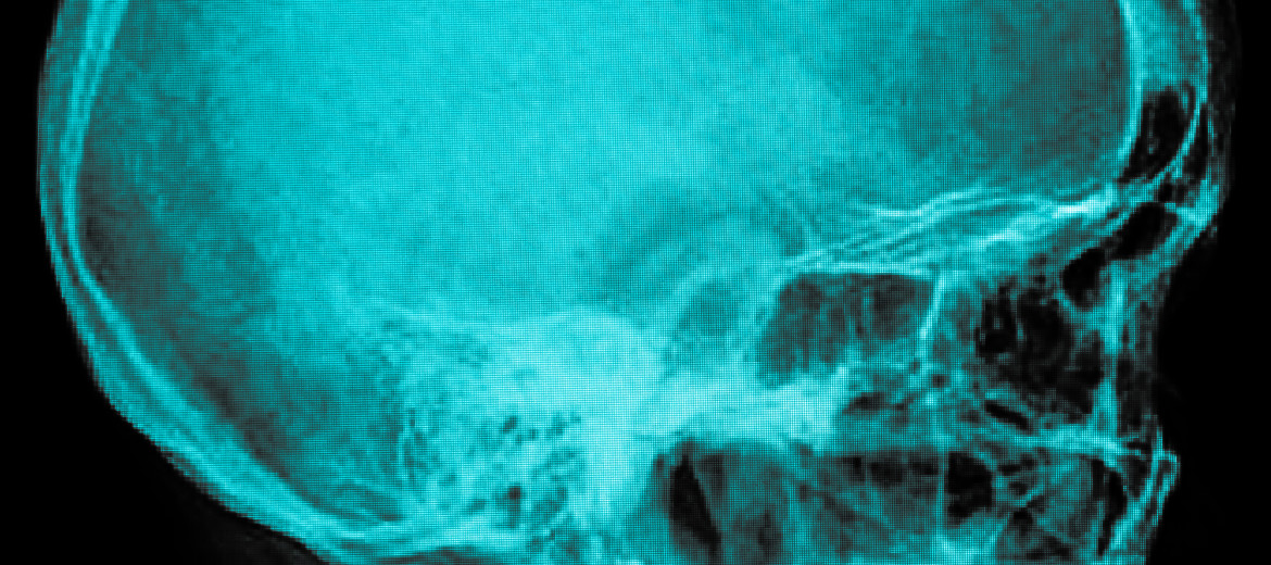 The Concussion Center at The Orthopedic Institute of New Jersey