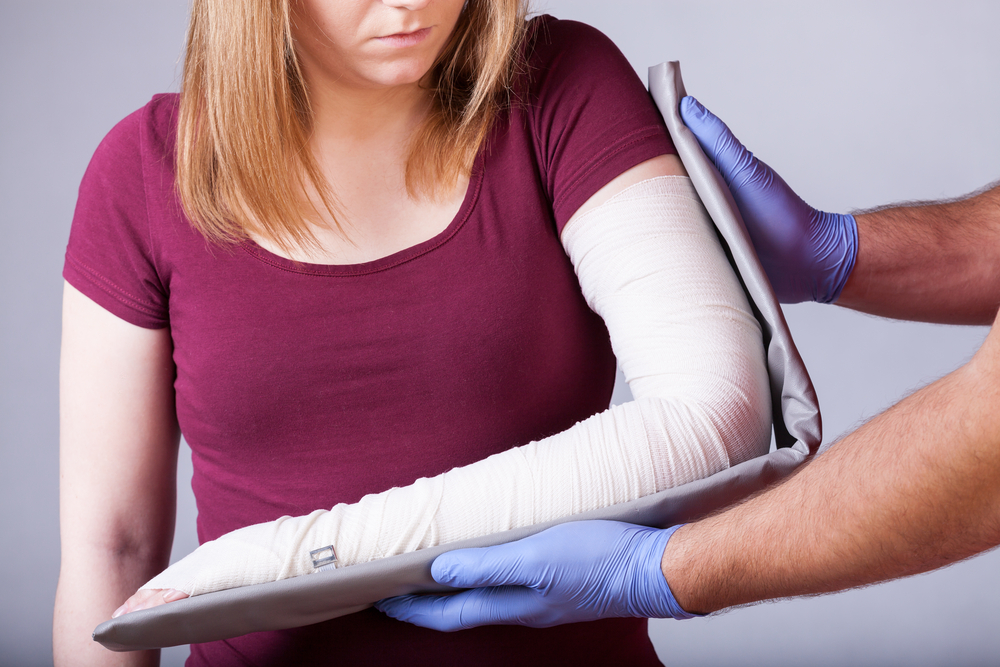 Elbow Fractures Elbow Fractures